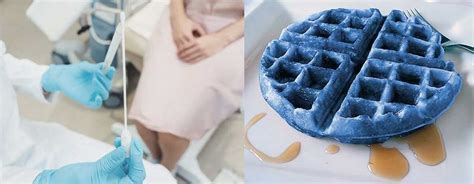 blue waffle disease vagina|Blue Waffle Disease 